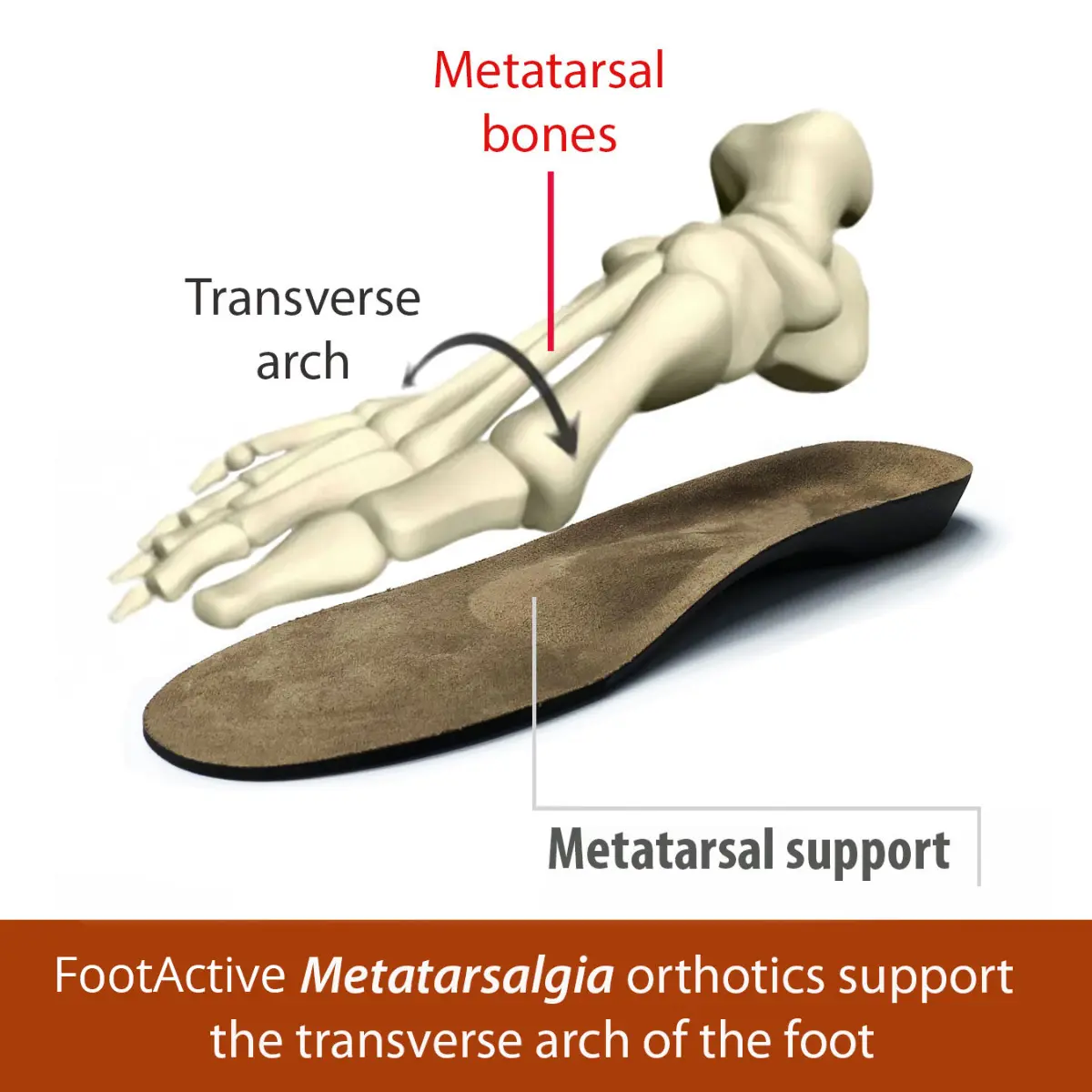 FootActive Metatarsalgia - Image 4